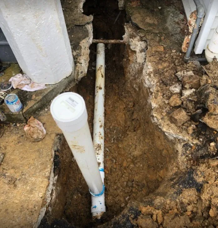 what-to-expect-during-the-sewer what-to-expect-during-the-sewer